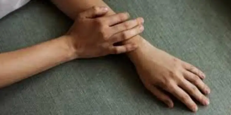 10 Cara Memutihkan Kembali Kulit yang Terbakar Sinar Matahari Secara Alami