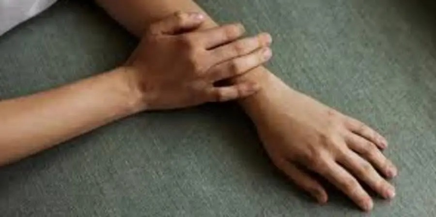 tangan belang akibat sinar matahari