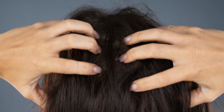 Penyebab Kulit Kepala Gatal dan Cara Mengatasinya Secara Alami