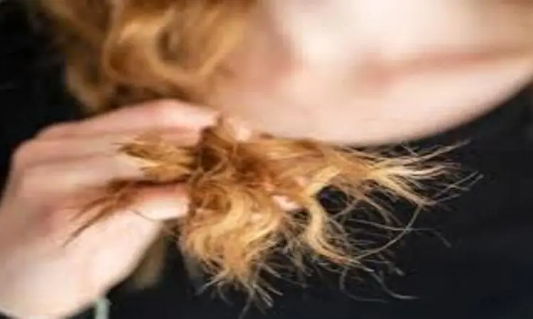 seorang wanita mengalami rambut bercabang