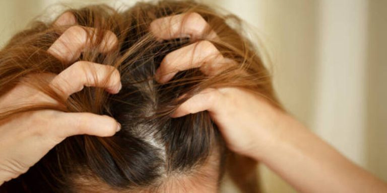 Kenapa Kulit Kepala Gatal? Ini Penyebab & Cara Mengatasinya