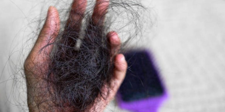 Kenapa Rambut Rontok di Usia Muda? Gaya Hidup Buruk yang Harus Dihindari