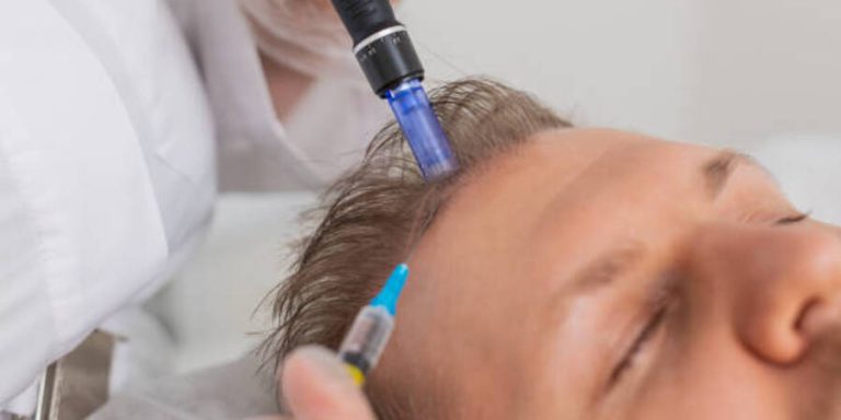 Ciri-Ciri Rambut Rontok Karena Penyakit yang Harus Diwaspadai