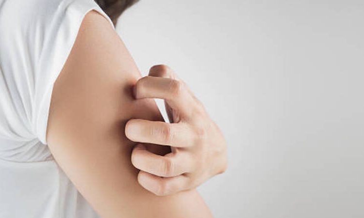 seorang eanita kulit kering