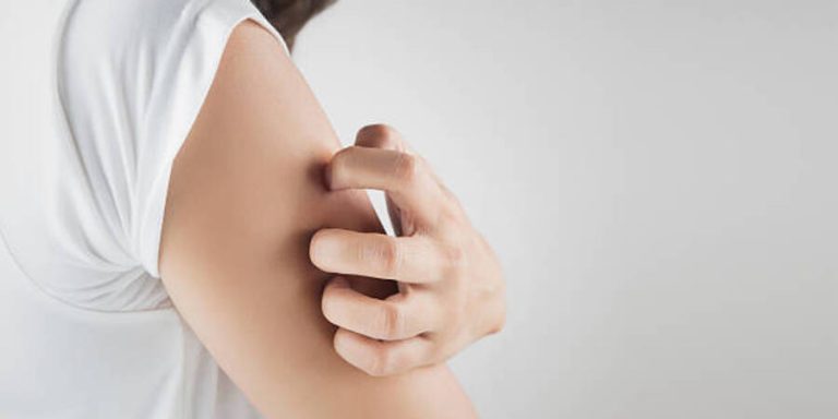 Kulit Kering dan Kusam Saat Puasa? Kenali Penyebab dan Solusi Alaminya