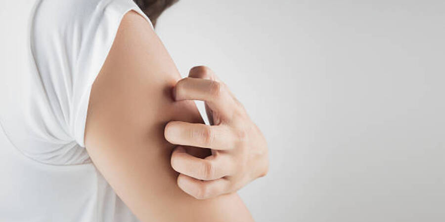 seorang eanita kulit kering