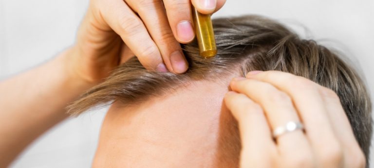 Rambut Bentuk M dan Jidat M: Penyebab, Solusi, dan Cara Merawatnya