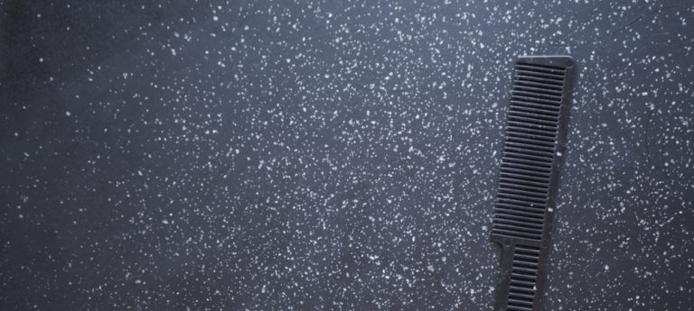 Rambut Rontok dan Ketombe: Penyebab, Cara Mengatasi, dan Tips Perawatan Ampuh