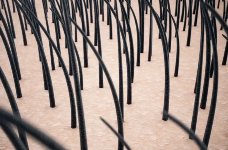 Waspadai, Ini Ciri-ciri Rambut Rontok Tidak Tumbuh Lagi!