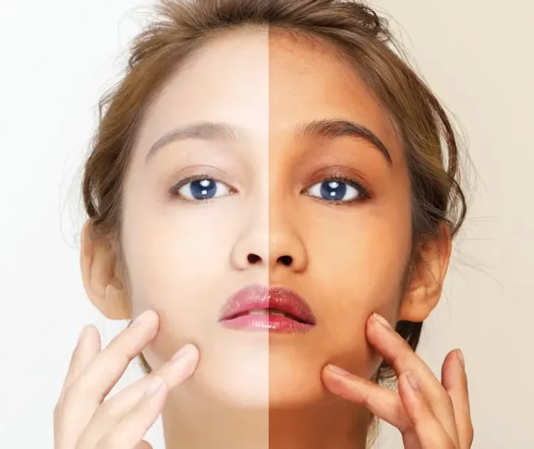 Beneran Bisa? Ini Cara Memutihkan Kulit dalam 3 Hari