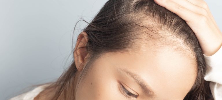 Cara Mengatasi Rambut Tipis dan Menipis: Panduan Lengkap