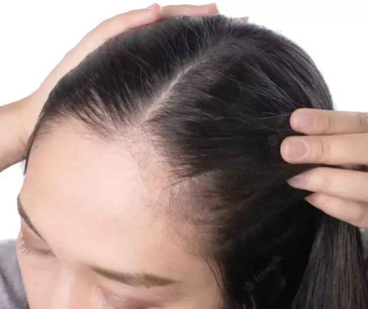 Rambut Sulah: Apa Itu dan Kenapa Bisa Terjadi?