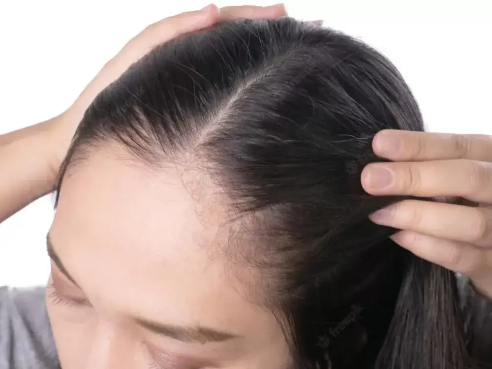 Rambut Sulah: Apa Itu dan Kenapa Bisa Terjadi?
