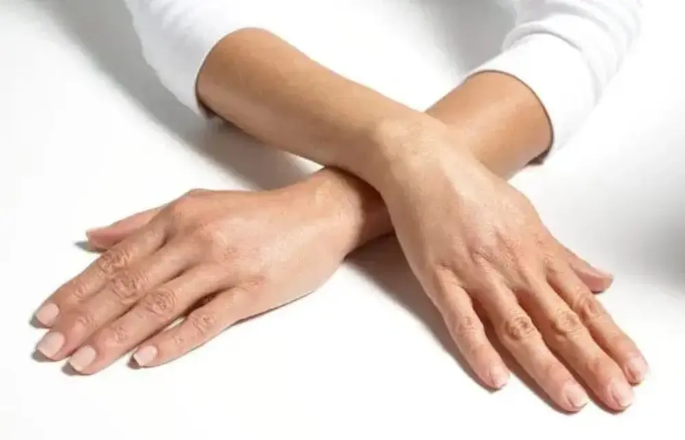 Cara Ampuh Mengatasi Kulit Belang dengan Body Lotion yang Tepat