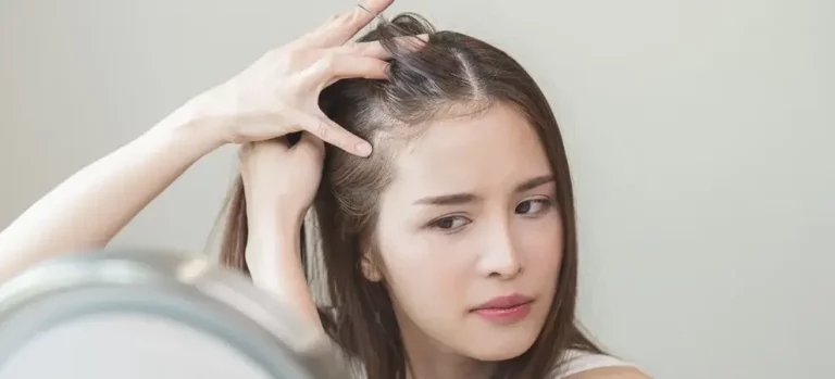 Penumbuh Rambut Botak dan Cepat: Solusi Ampuh Atasi Kebotakan Sejak Dini