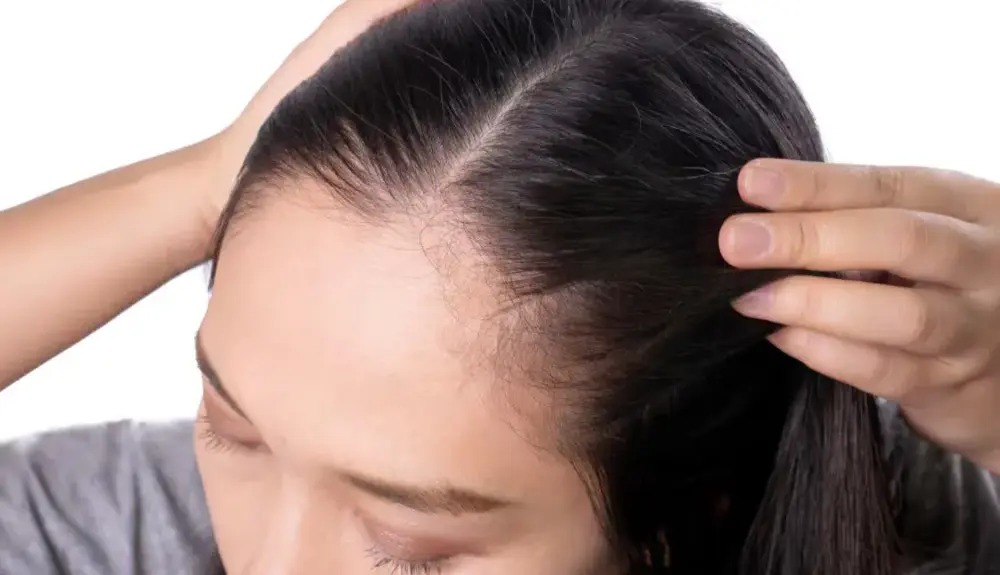 Rambut Pitak: Penyebab, Cara Mengatasi, dan Tips Perawatan