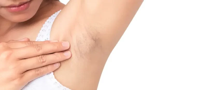 Deodoran Bebas Alkohol: Pilihan Lebih Aman untuk Kulit Sensitif dan Ketiak Sehat