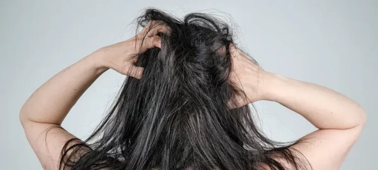 Kenapa Kulit Kepala Gatal Padahal Sudah Keramas? Ini Penyebab dan Solusinya