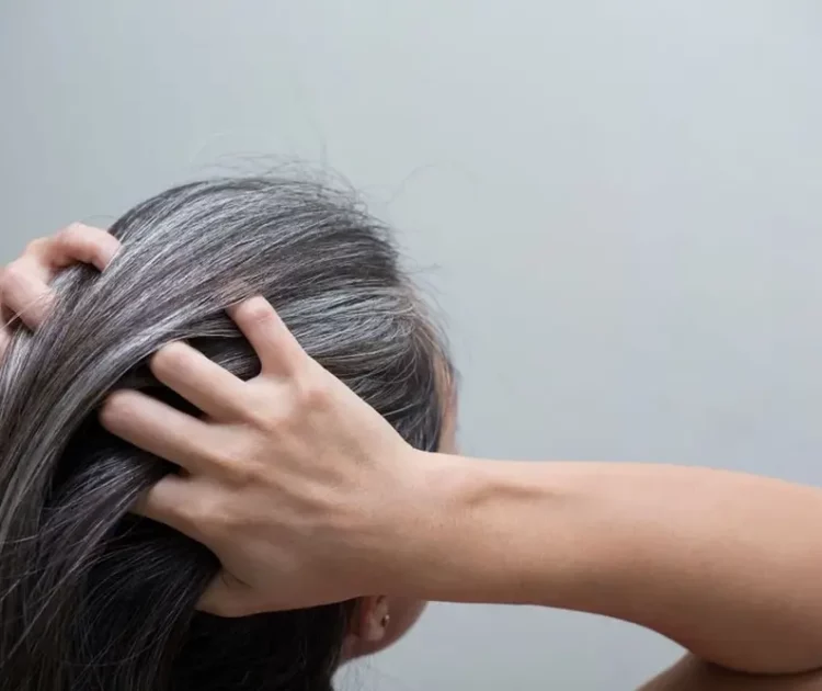 Cara Menghilangkan Uban Secara Alami agar Tidak Tumbuh Lagi