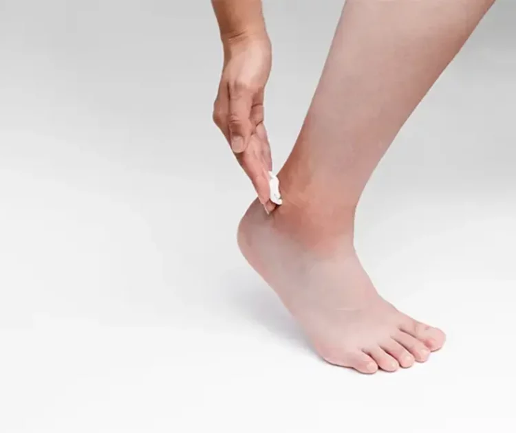 kaki kering penyebab dan cara mengatasinya