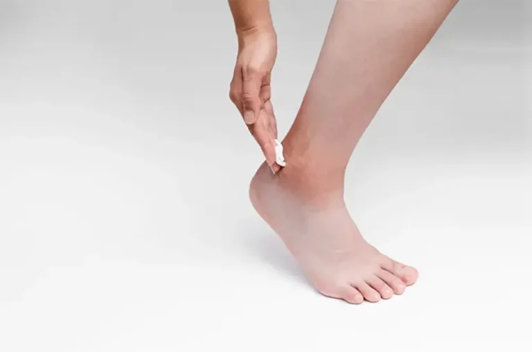 Kaki Kering: Penyebab, Cara Mengatasi, dan Perawatan Harian yang Tepat