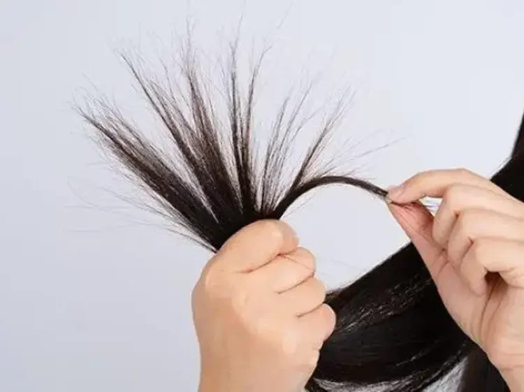 Penyebab Rambut Tipis, Perawatan, dan Solusinya