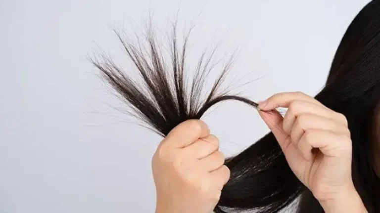 Penyebab Rambut Tipis, Perawatan, dan Solusinya