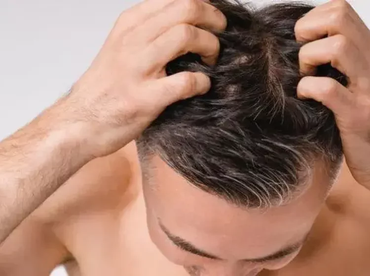 Masalah Rambut Bercabang pada Pria: Kenapa Bisa Terjadi?