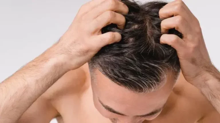 Masalah Rambut Bercabang pada Pria: Kenapa Bisa Terjadi?