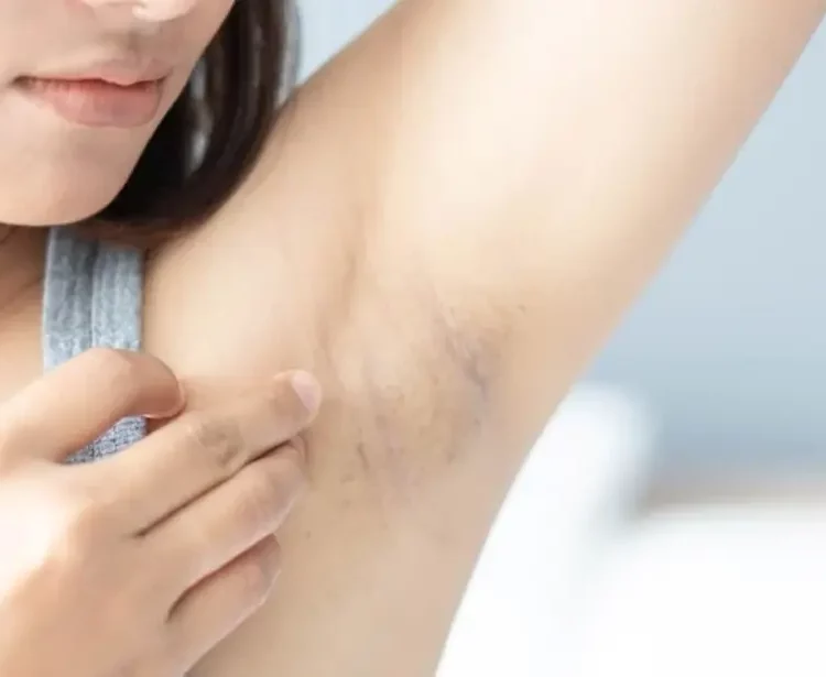 Deodorant yang Tidak Membuat Ketiak Hitam dan Tetap Cerah