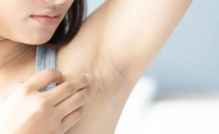 Deodorant yang Tidak Membuat Ketiak Hitam dan Tetap Cerah