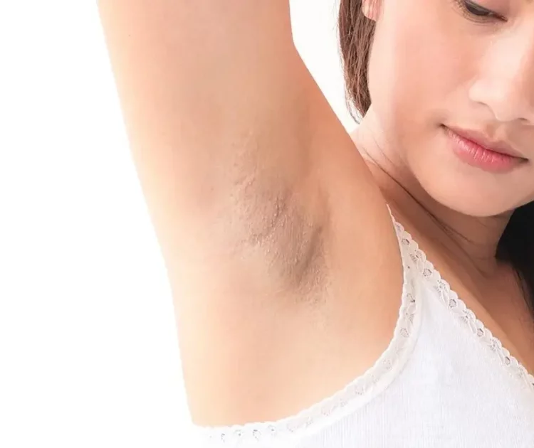 Gatal di Ketiak dan Menghitam: Penyebab dan Cara Mengatasinya