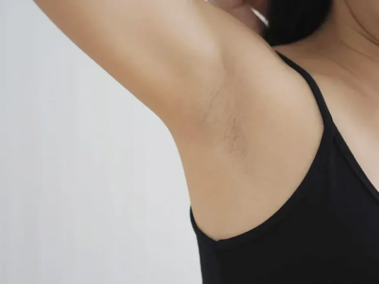 Ketiak Gelap: Penyebab, Cara Mengatasi, dan Tips Mencegahnya