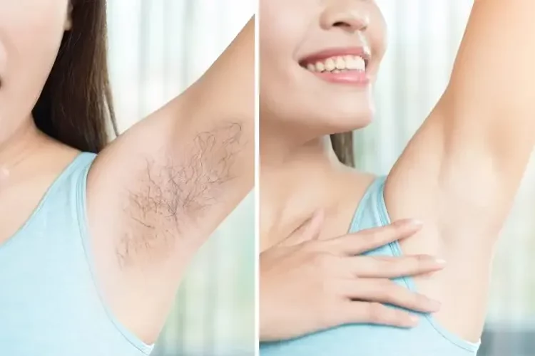 Cara Menghilangkan Bulu Ketiak, Ketiak Halus dan Bersih!