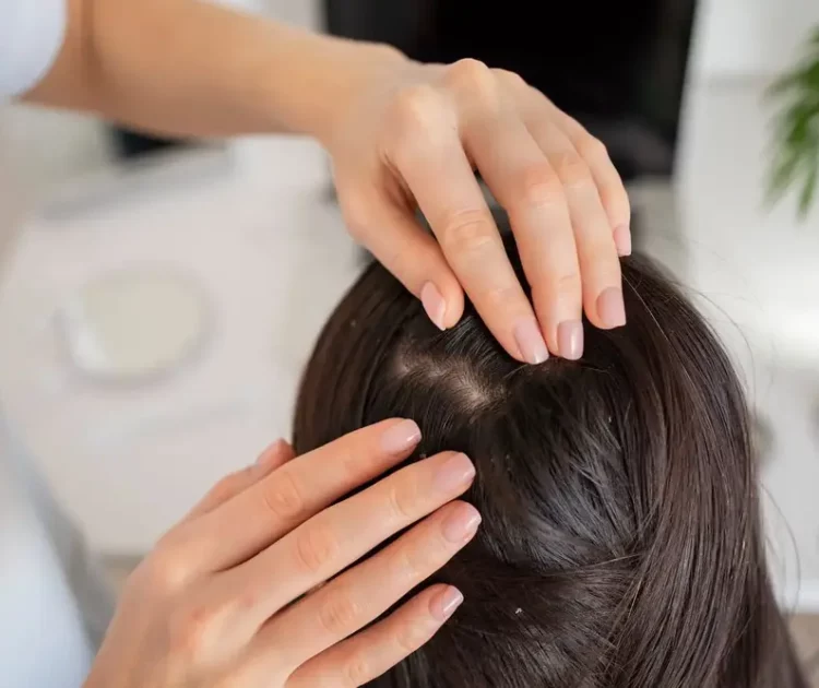 Mengenal Folikel Rambut dan Fungsinya