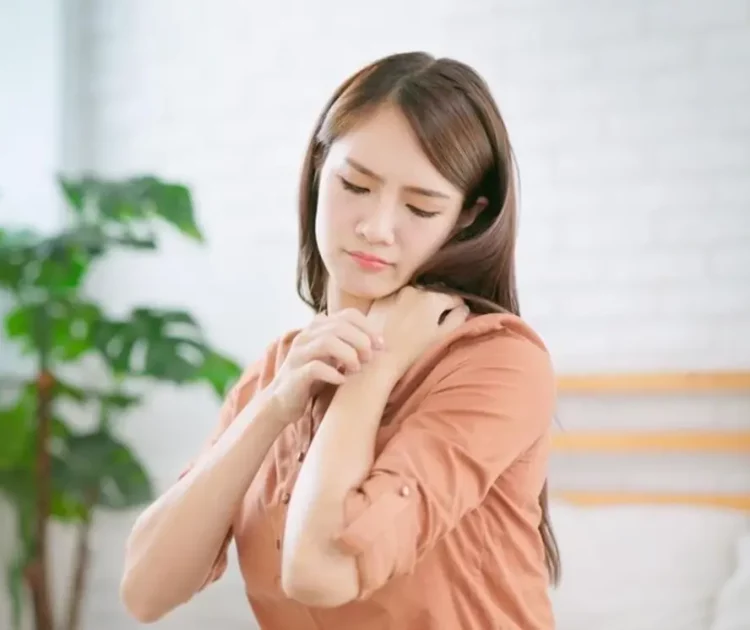 Bebas Gatal, Kulit Tetap Lembap dengan Lotion Anti Gatal!