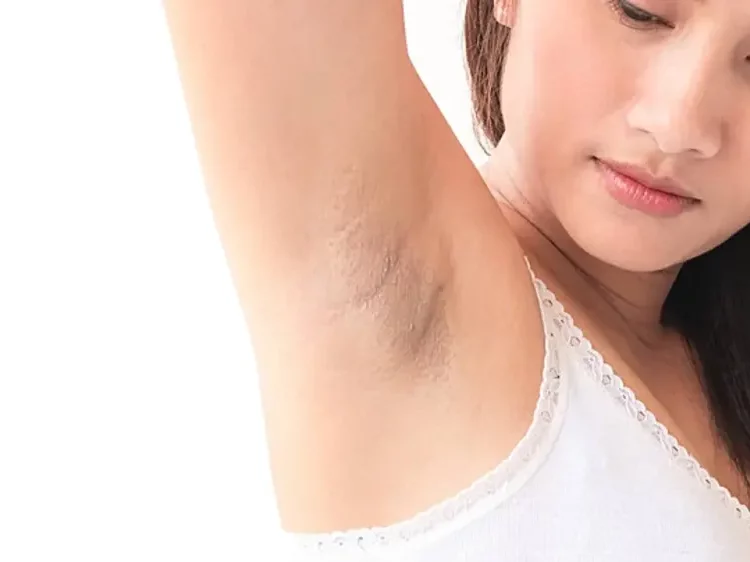 Penyebab Ketiak Hitam