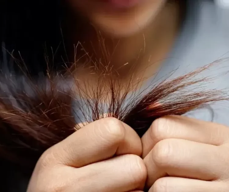 Perawatan Batang Rambut Agar Kuat dan Sehat