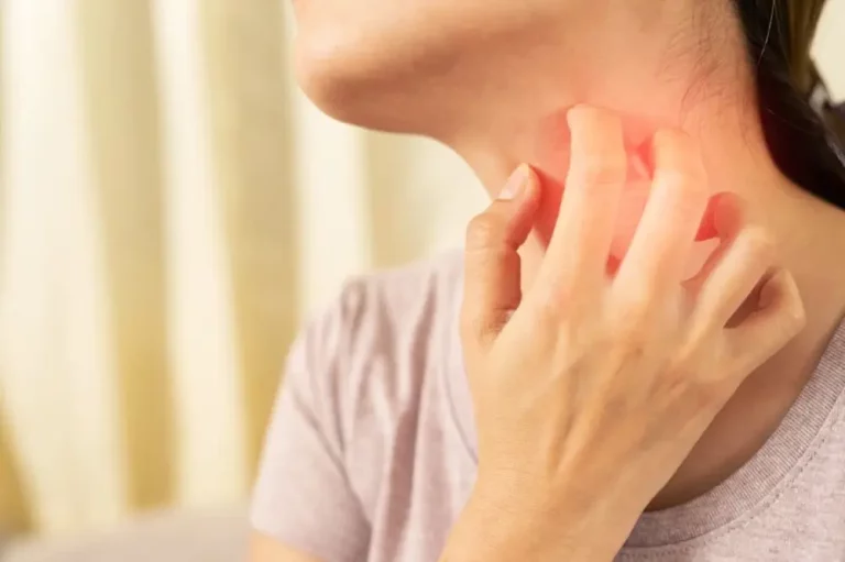 Alergi Keringat: Kenali dan Atasi Agar Kulit Tetap Lembap