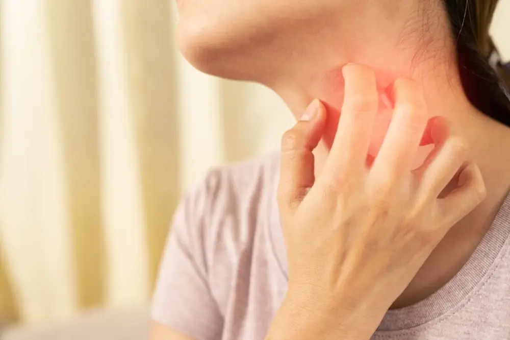 Alergi Keringat: Kenali dan Atasi Agar Kulit Tetap Lembap dan Bebas Iritasi