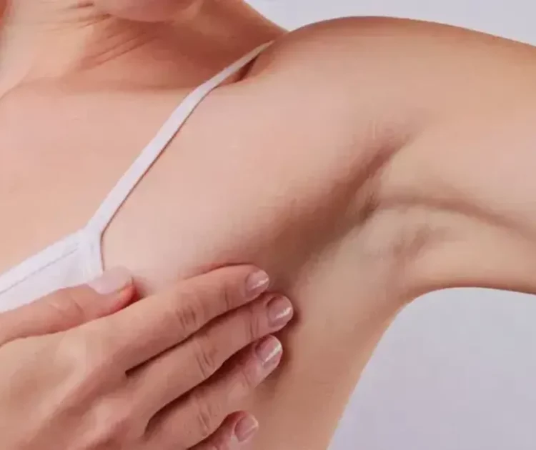 Infeksi Jamur Ketiak: Gejala, Penyebab, dan Pengobatan