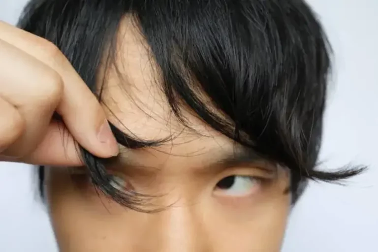 Rambut Kering Pria: Penyebab, Perawatan, dan Solusi