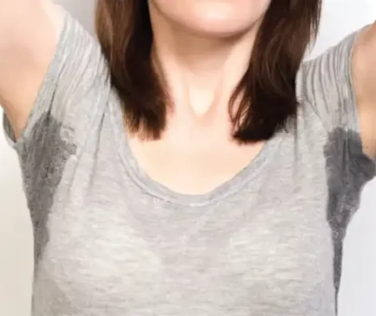 Mengatasi Ketiak Basah Berlebihan: Tips dan Solusinya