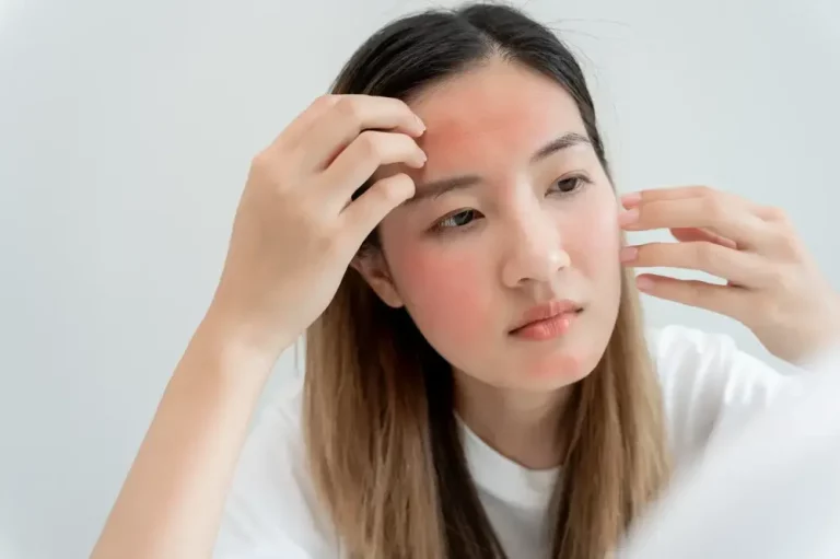 Kulit Sensitif? Temukan Solusi Perawatan yang Tepat