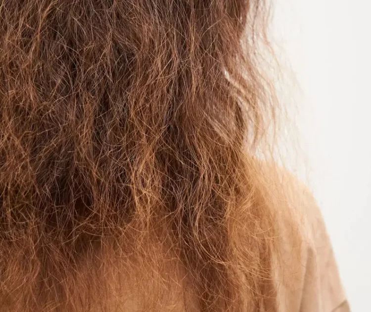 Ciri-ciri Rambut Kering dan Cara Menjaganya Tetap Sehat