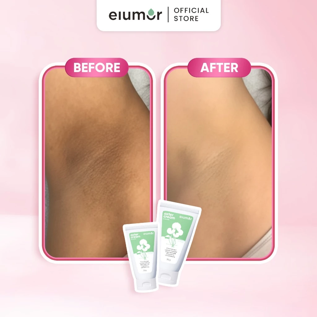 Elumor Oxter Cream New Formula 30gr - Image 8